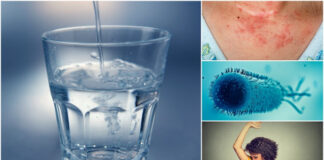 Príznaky akútneho nedostatku vody v tele