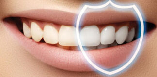 Domáce bielenie zubov